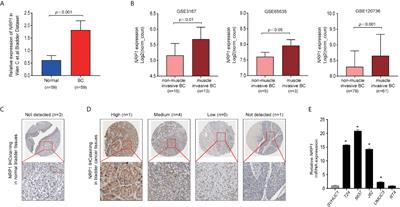 Role of NRP1 in Bladder Cancer Pathogenesis and Progression